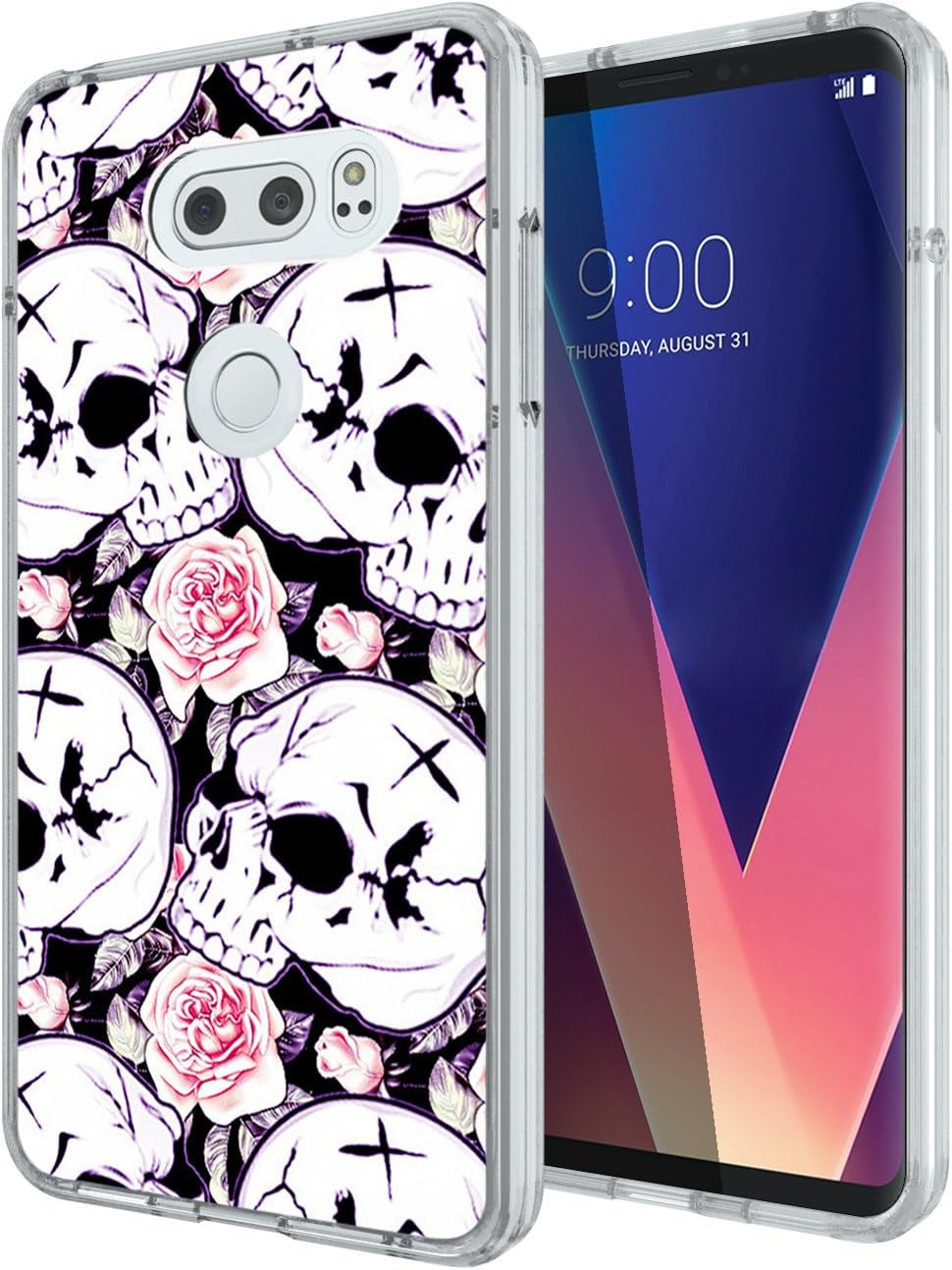 Pink Case for LG V30,Gifun Slim Soft TPU Protective Case Compatible with LG V30/V30 Plus/V30S - Pink Pig Gifun Skull Rose