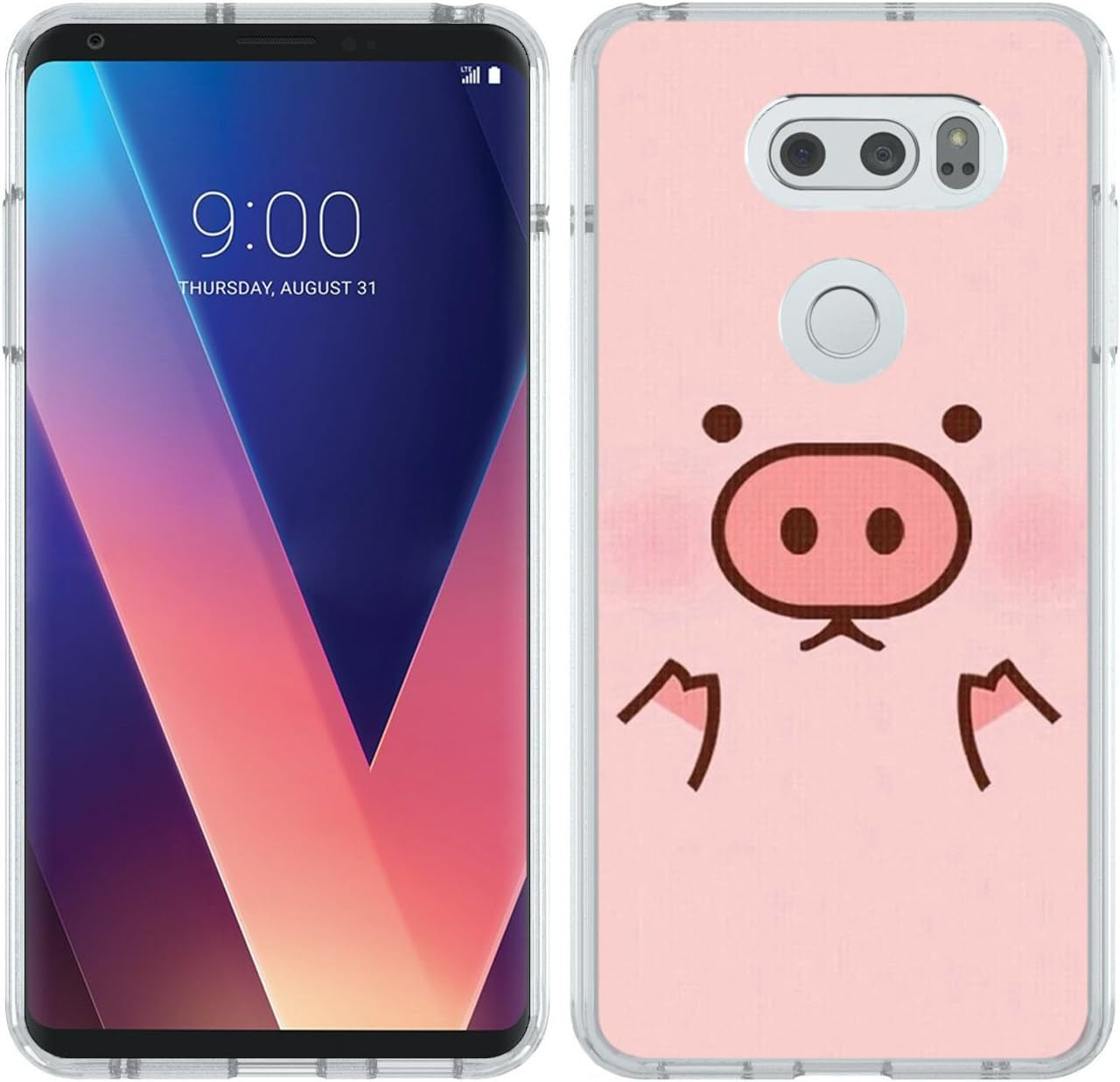 Pink Case for LG V30,Gifun Slim Soft TPU Protective Case Compatible with LG V30/V30 Plus/V30S - Pink Pig  Gifun   